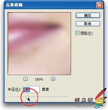 减轻雀斑和面部痤疮